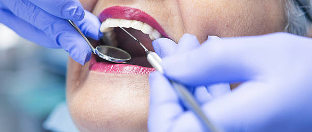 Best Urgent Care for Lost Fillings or Crowns in Albion, MI